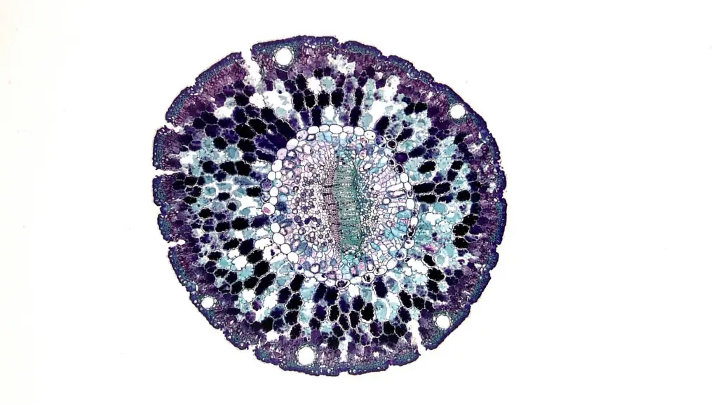 Todo sobre el VPH (Virus del papiloma humano) 1 vph miriam al adib